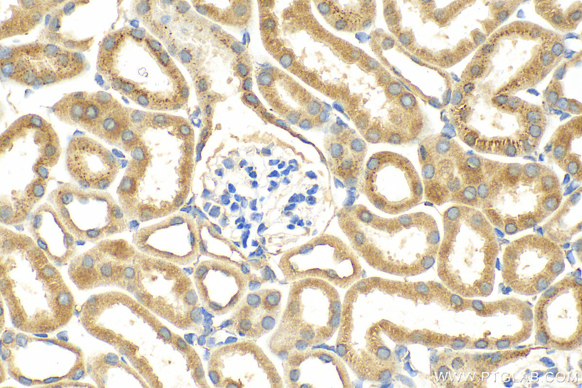 Immunohistochemistry (IHC) staining of mouse kidney tissue using IFIT1 Polyclonal antibody (23247-1-AP)