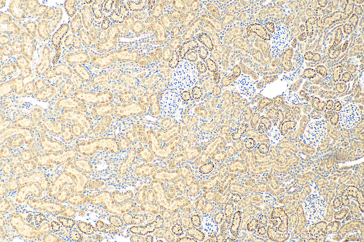 Immunohistochemistry (IHC) staining of rat kidney tissue using IFIT1 Polyclonal antibody (23247-1-AP)