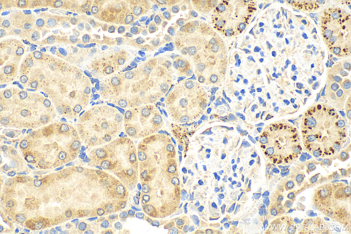 Immunohistochemistry (IHC) staining of rat kidney tissue using IFIT1 Polyclonal antibody (23247-1-AP)