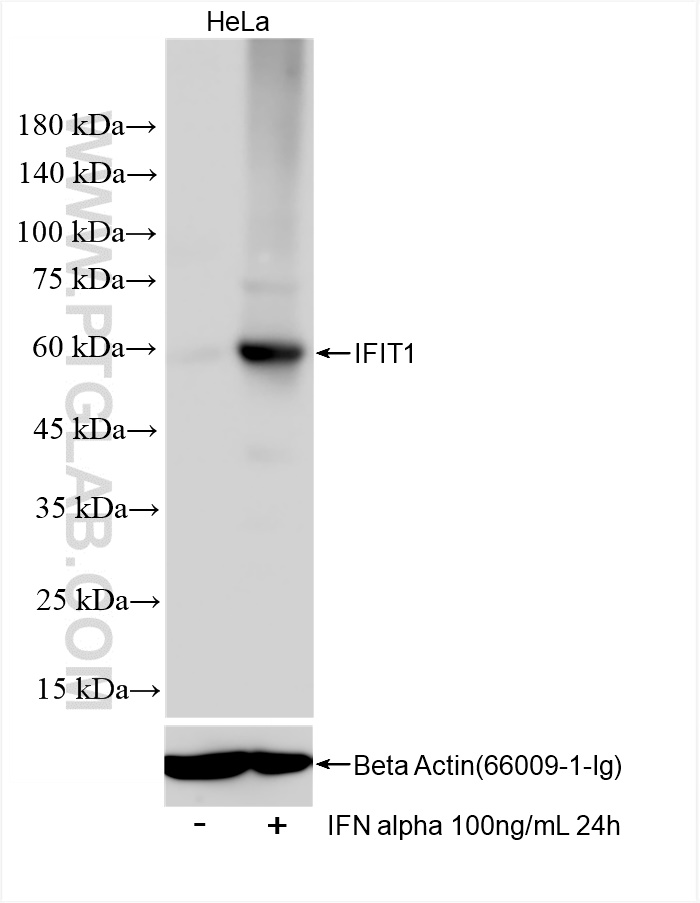 Western Blot (WB) analysis of HeLa cells using IFIT1 Recombinant antibody (83423-1-RR)