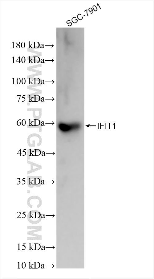 Western Blot (WB) analysis of SGC-7901 cells using IFIT1 Recombinant antibody (83423-1-RR)