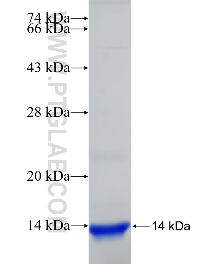 IFIT1 fusion protein Ag31980 SDS-PAGE