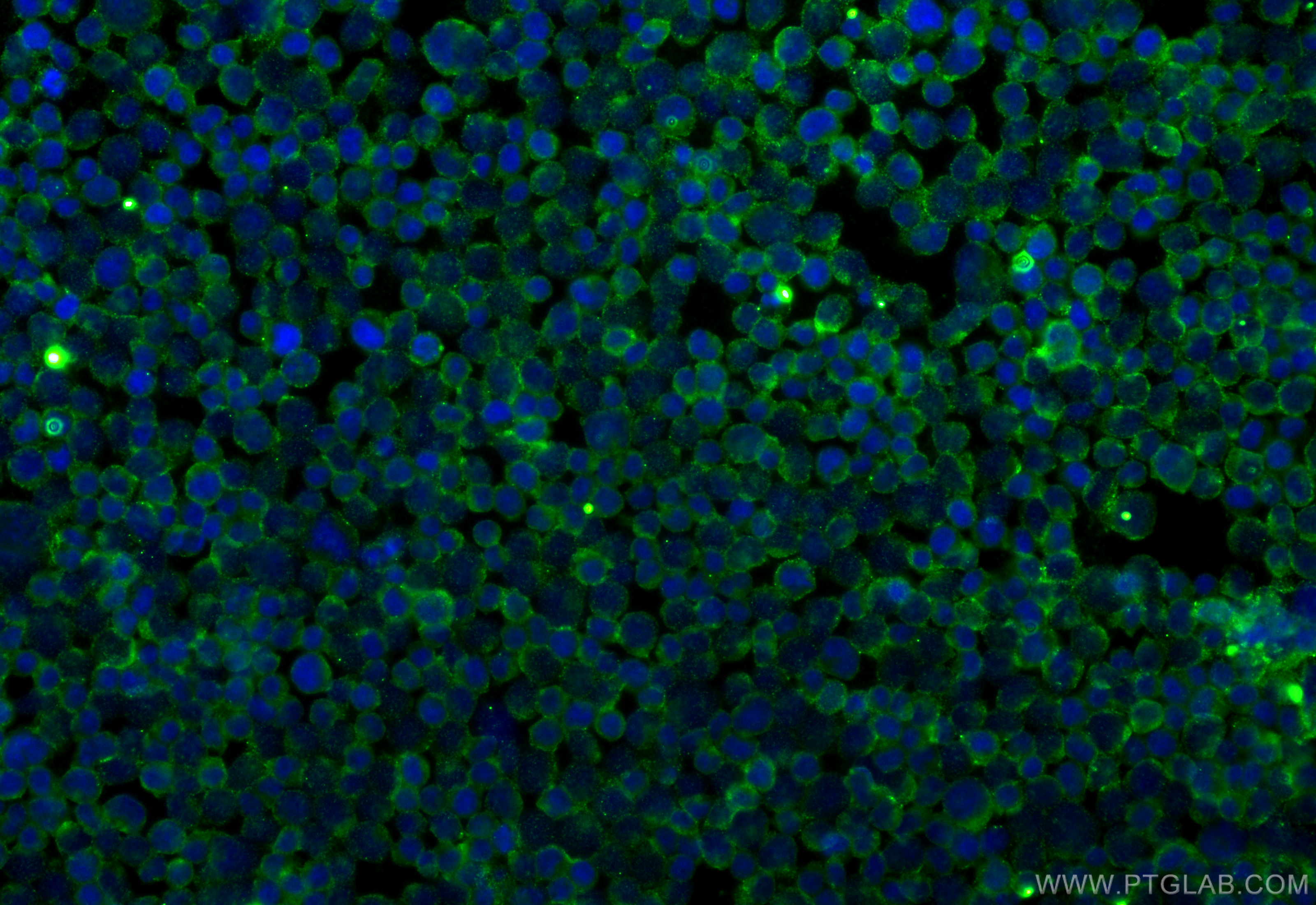 Immunofluorescence (IF) / fluorescent staining of Jurkat cells using IFITM1-Specific Monoclonal antibody (60074-1-Ig)