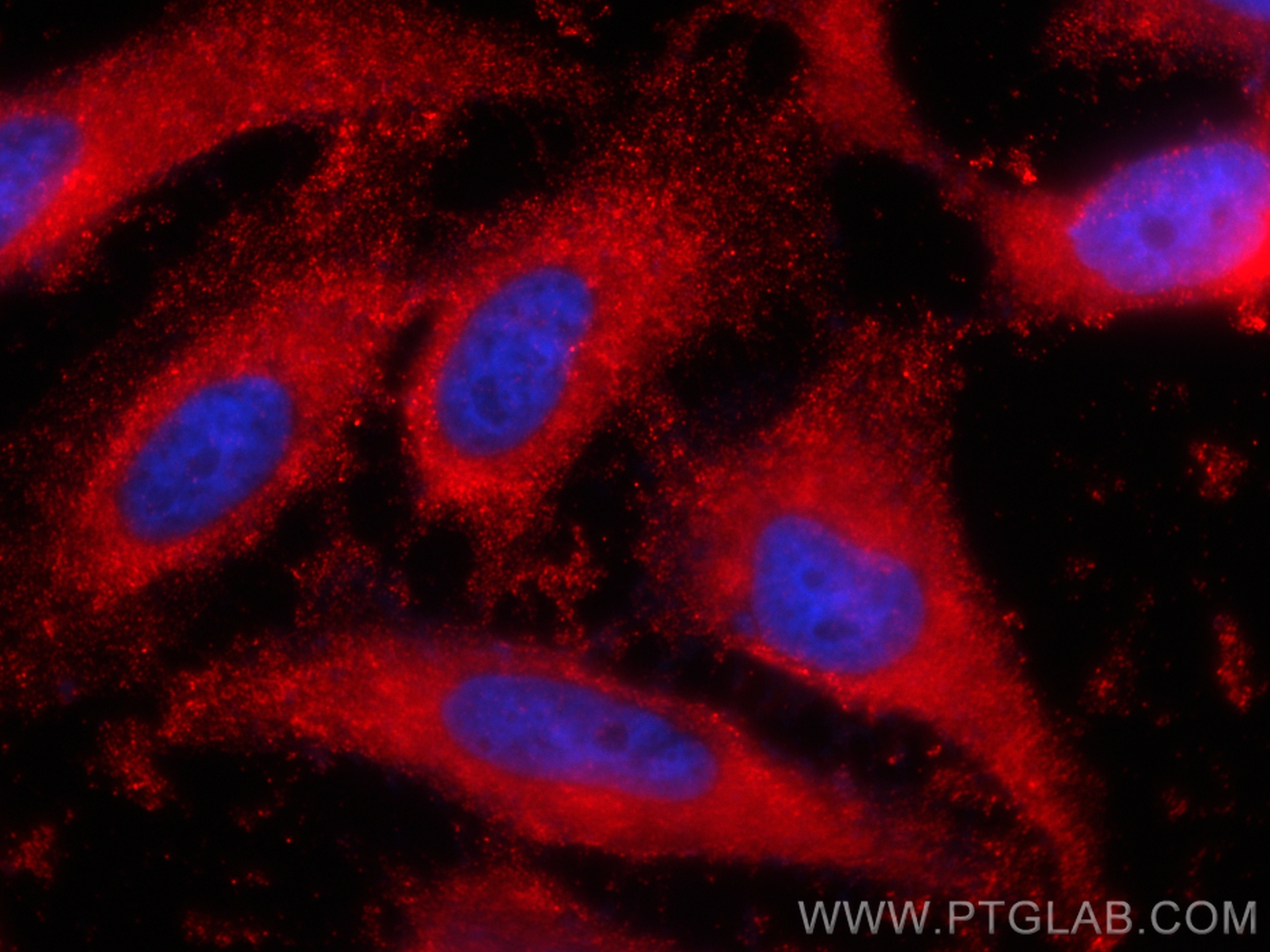 Immunofluorescence (IF) / fluorescent staining of HeLa cells using CoraLite®594-conjugated IFITM2/3 Monoclonal antibo (CL594-66081)