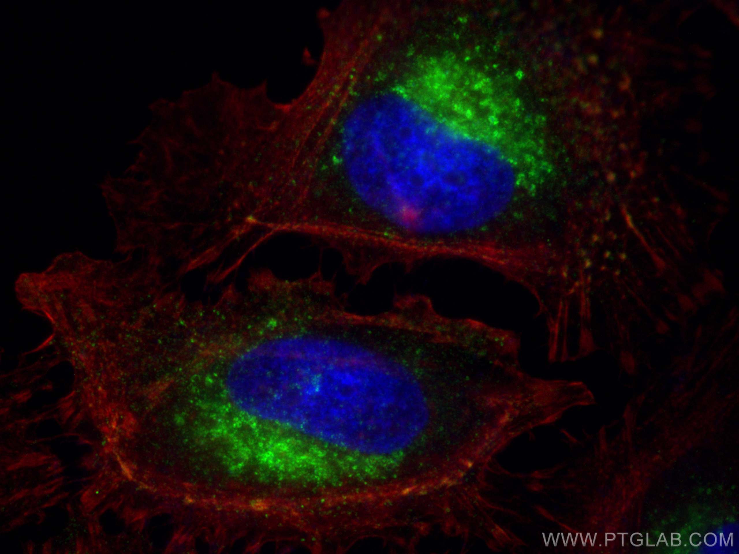 Immunofluorescence (IF) / fluorescent staining of HeLa cells using IFITM2 Polyclonal antibody (12769-1-AP)