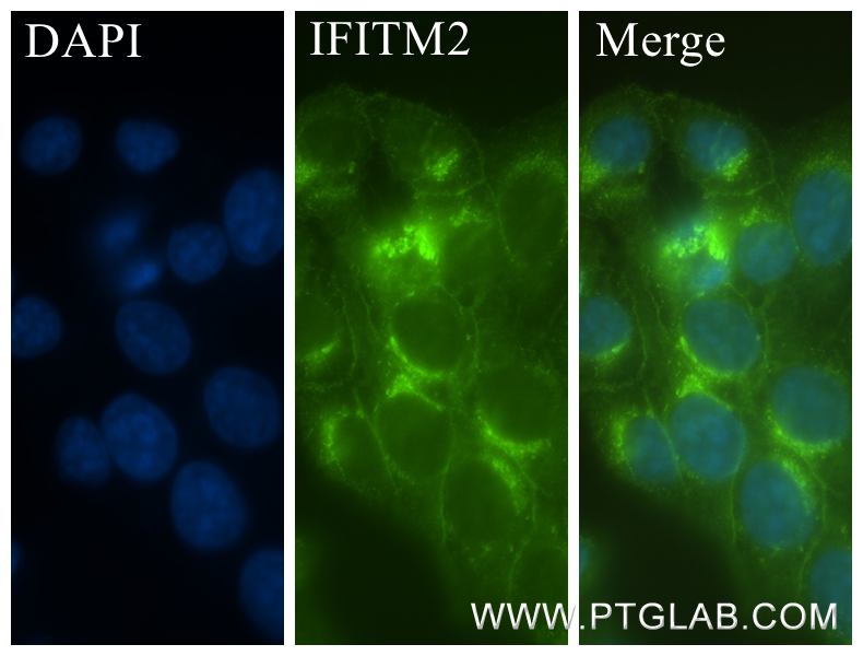 Immunofluorescence (IF) / fluorescent staining of HepG2 cells using IFITM2 Recombinant antibody (83455-5-RR)