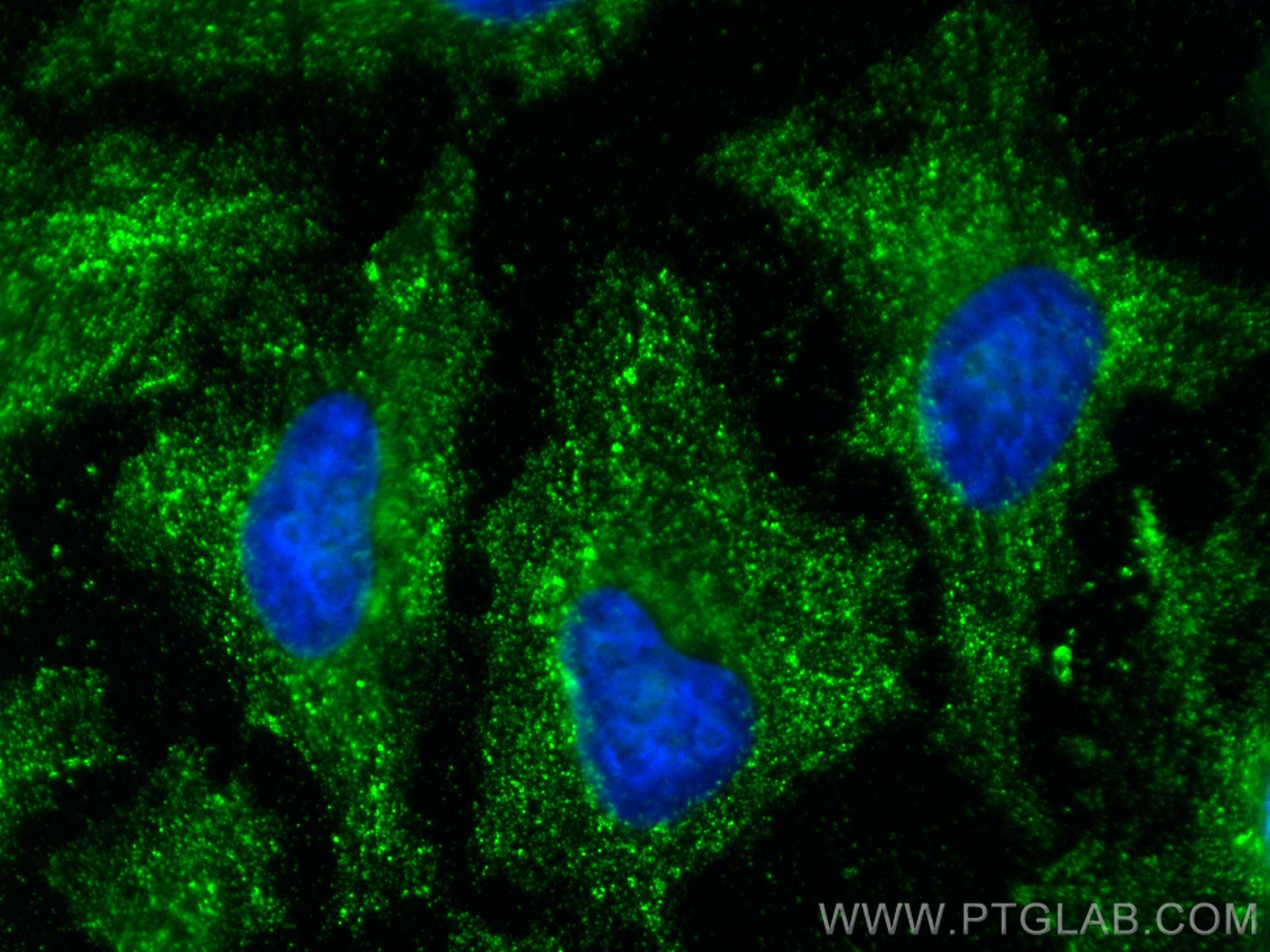 Immunofluorescence (IF) / fluorescent staining of HeLa cells using IFITM2/3 Monoclonal antibody (66081-1-Ig)