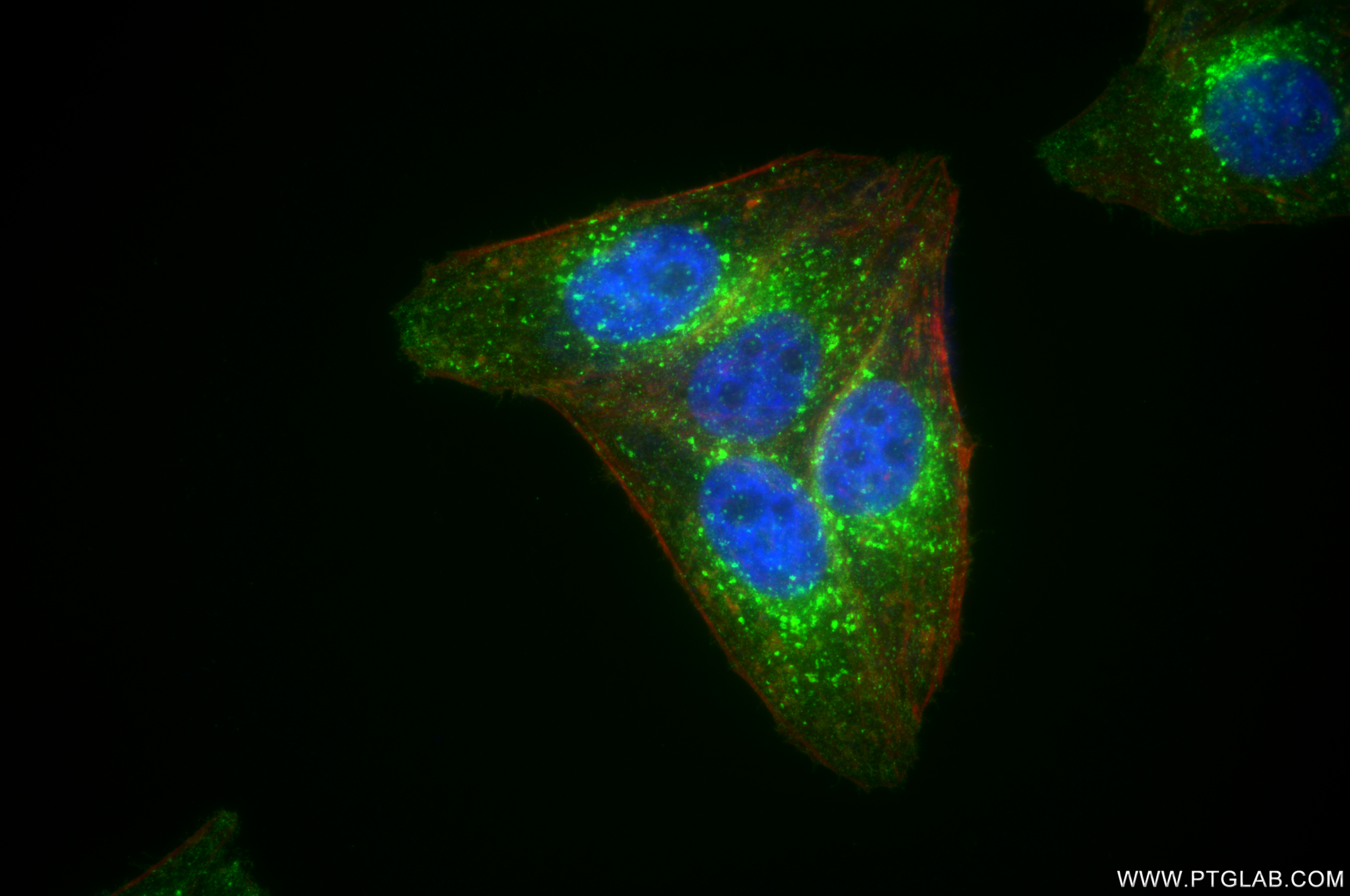 Immunofluorescence (IF) / fluorescent staining of HepG2 cells using IFITM3 Recombinant antibody (81135-3-RR)