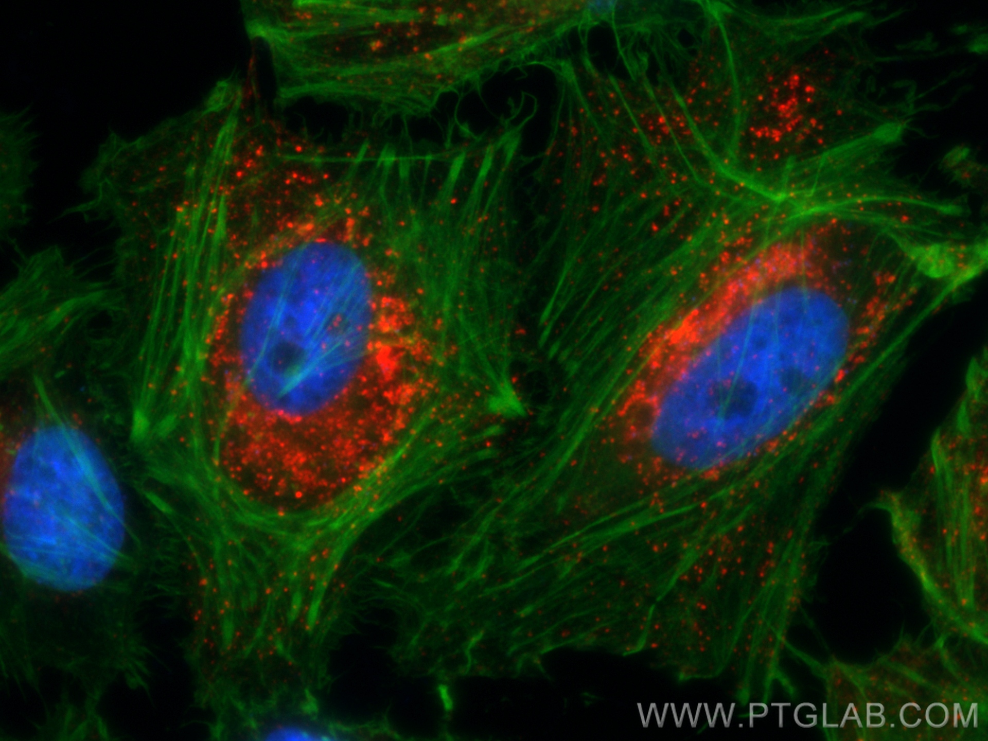 Immunofluorescence (IF) / fluorescent staining of HeLa cells using CoraLite®594-conjugated IFITM3 Polyclonal antibody (CL594-11714)