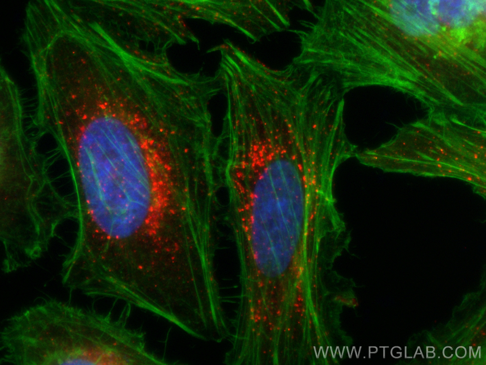 Immunofluorescence (IF) / fluorescent staining of HeLa cells using CoraLite®594-conjugated IFITM3 Polyclonal antibody (CL594-11714)