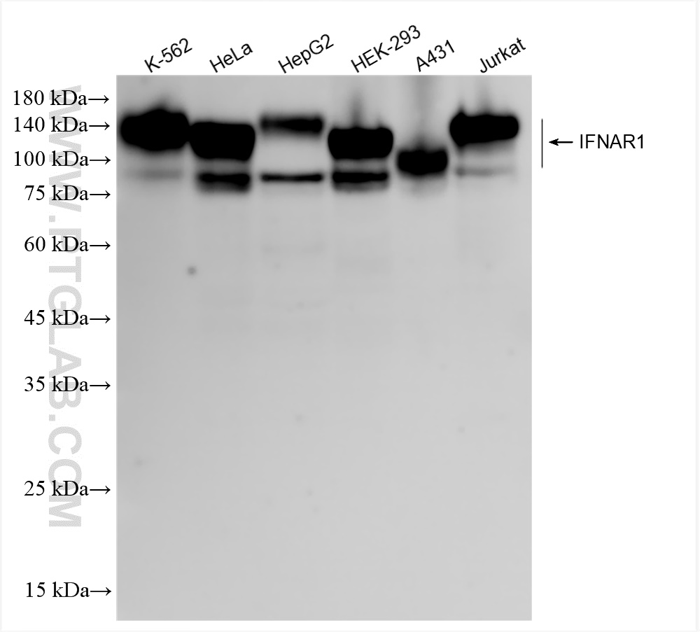 Western Blot (WB) analysis of various lysates using IFNAR1 Recombinant antibody (83002-4-RR)