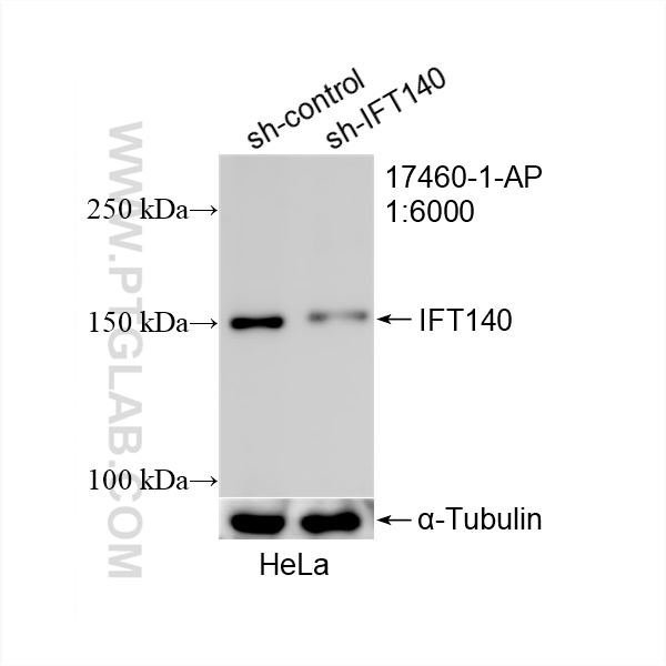 Western Blot (WB) analysis of HeLa cells using IFT140 Polyclonal antibody (17460-1-AP)