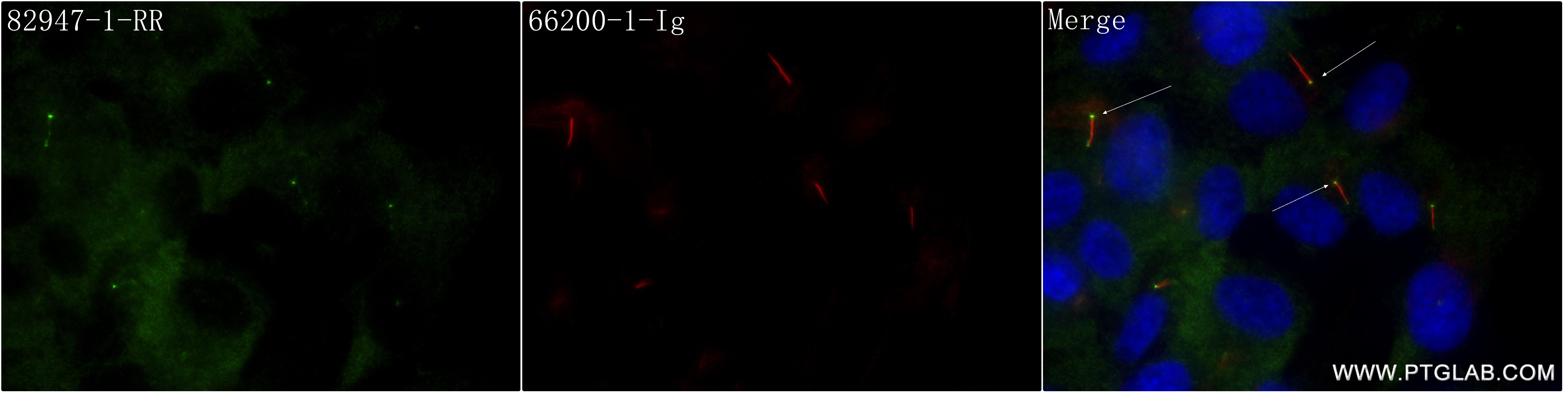 Immunofluorescence (IF) / fluorescent staining of hTERT-RPE1 cells using IFT140 Recombinant antibody (82947-1-RR)
