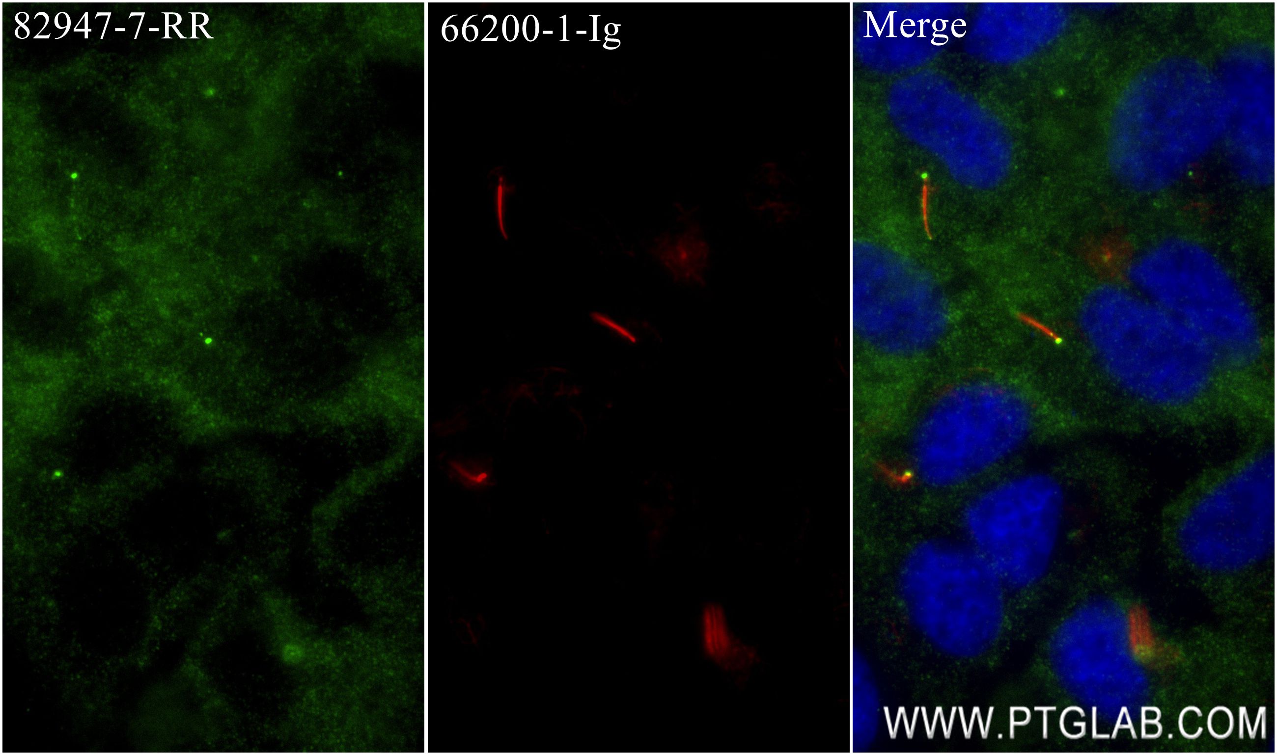 Immunofluorescence (IF) / fluorescent staining of hTERT-RPE1 cells using IFT140 Recombinant antibody (82947-7-RR)