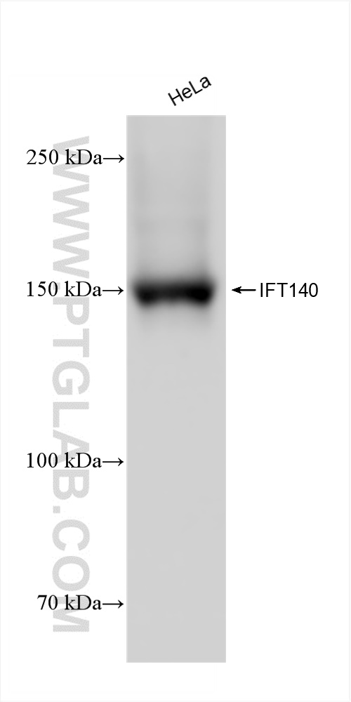 Western Blot (WB) analysis of HeLa cells using IFT140 Recombinant antibody (82947-7-RR)