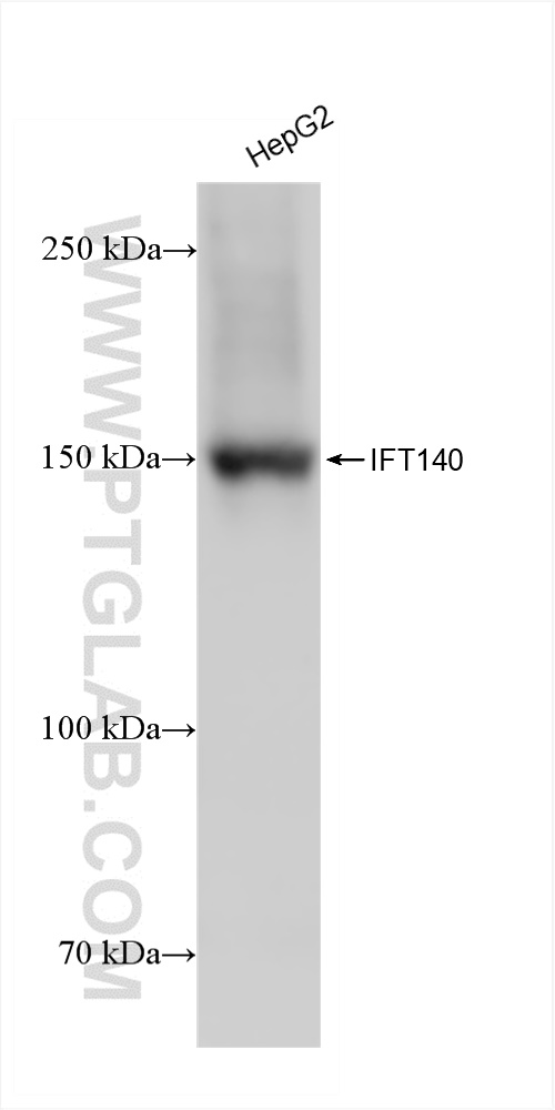 Western Blot (WB) analysis of HepG2 cells using IFT140 Recombinant antibody (82947-7-RR)