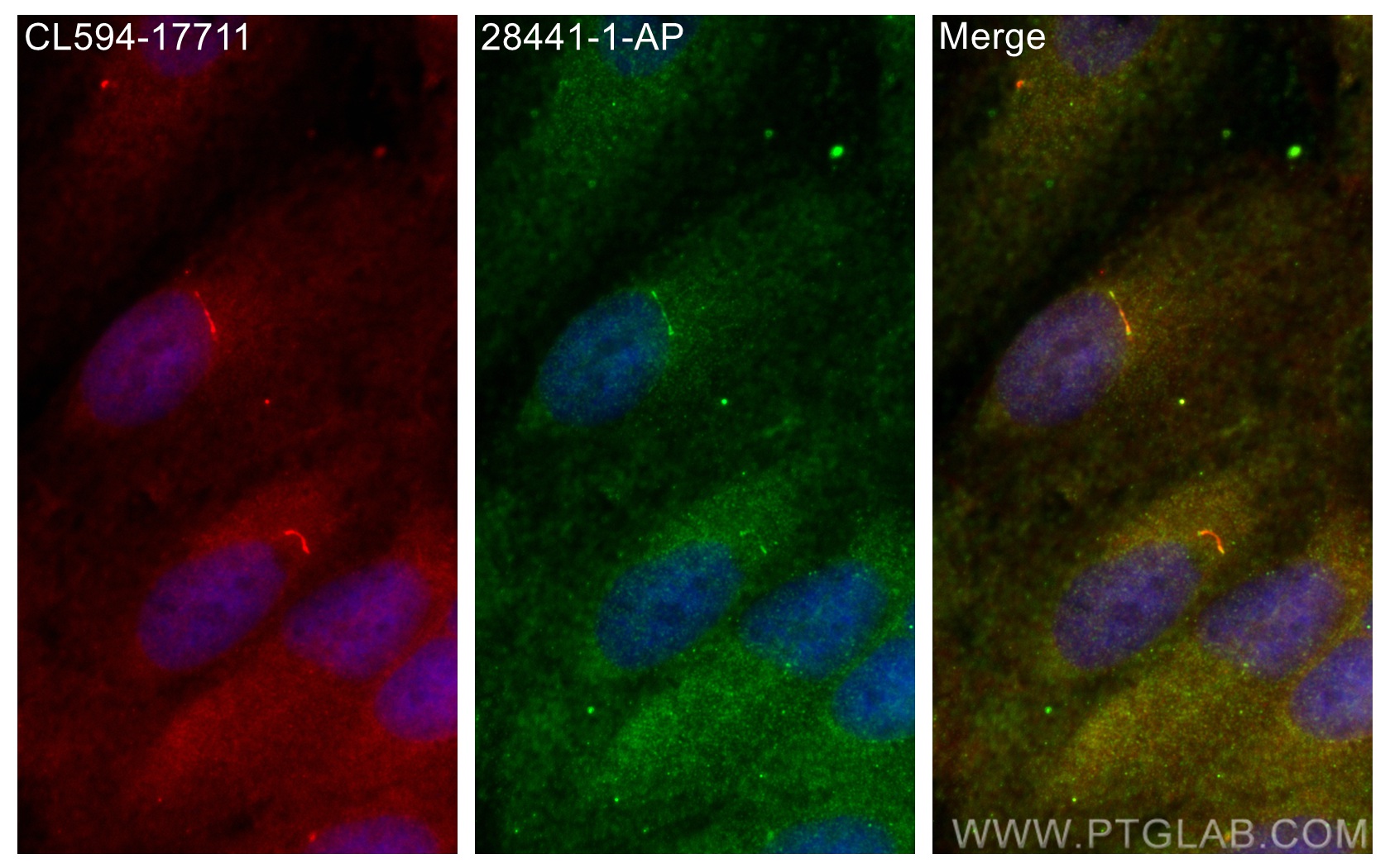 Immunofluorescence (IF) / fluorescent staining of ARPE-19 cells using IFT172 Polyclonal antibody (28441-1-AP)