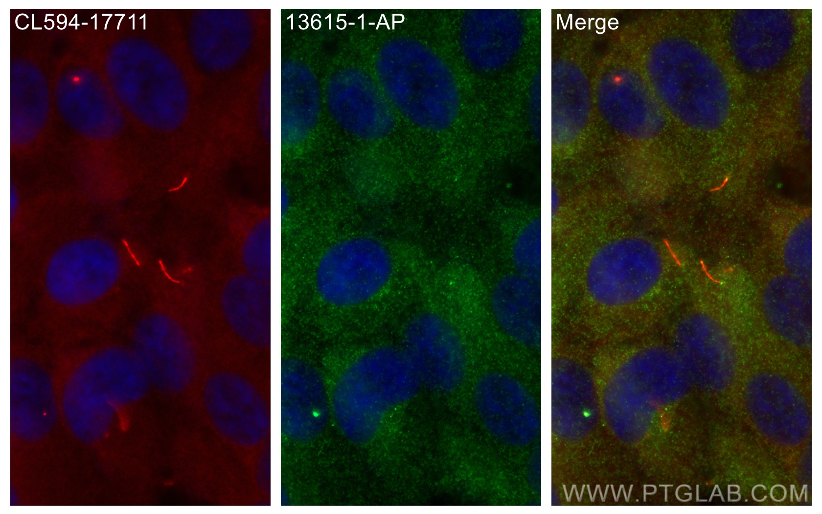 Immunofluorescence (IF) / fluorescent staining of hTERT-RPE1 cells using IFT20 Polyclonal antibody (13615-1-AP)