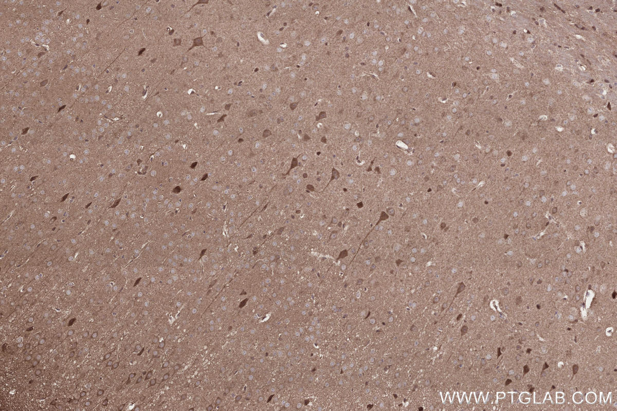 Immunohistochemistry (IHC) staining of mouse brain tissue using IFT20 Polyclonal antibody (13615-1-AP)