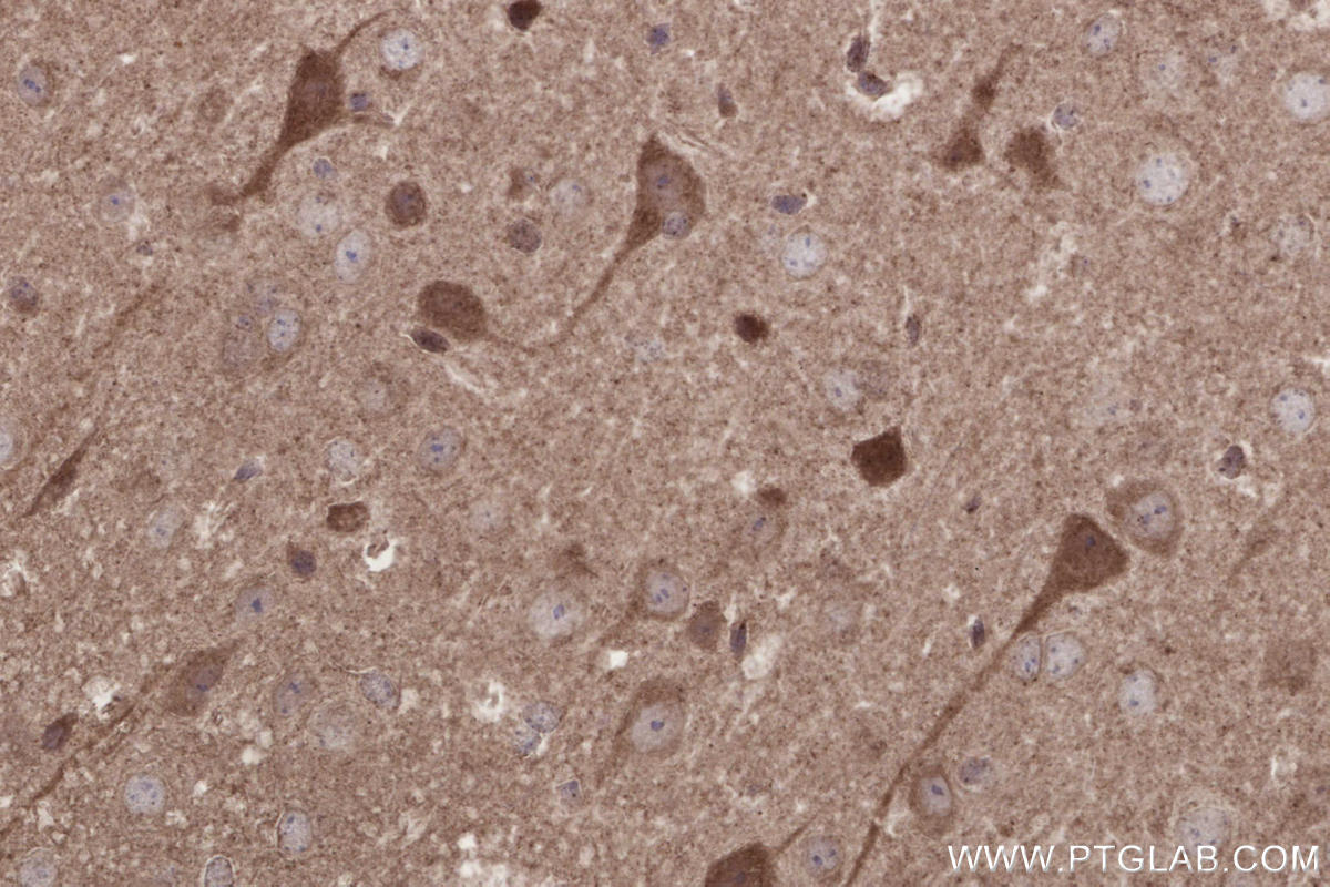Immunohistochemistry (IHC) staining of mouse brain tissue using IFT20 Polyclonal antibody (13615-1-AP)