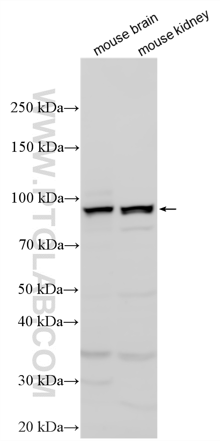 Western Blot (WB) analysis of various lysates using IFT80 Polyclonal antibody (25230-1-AP)