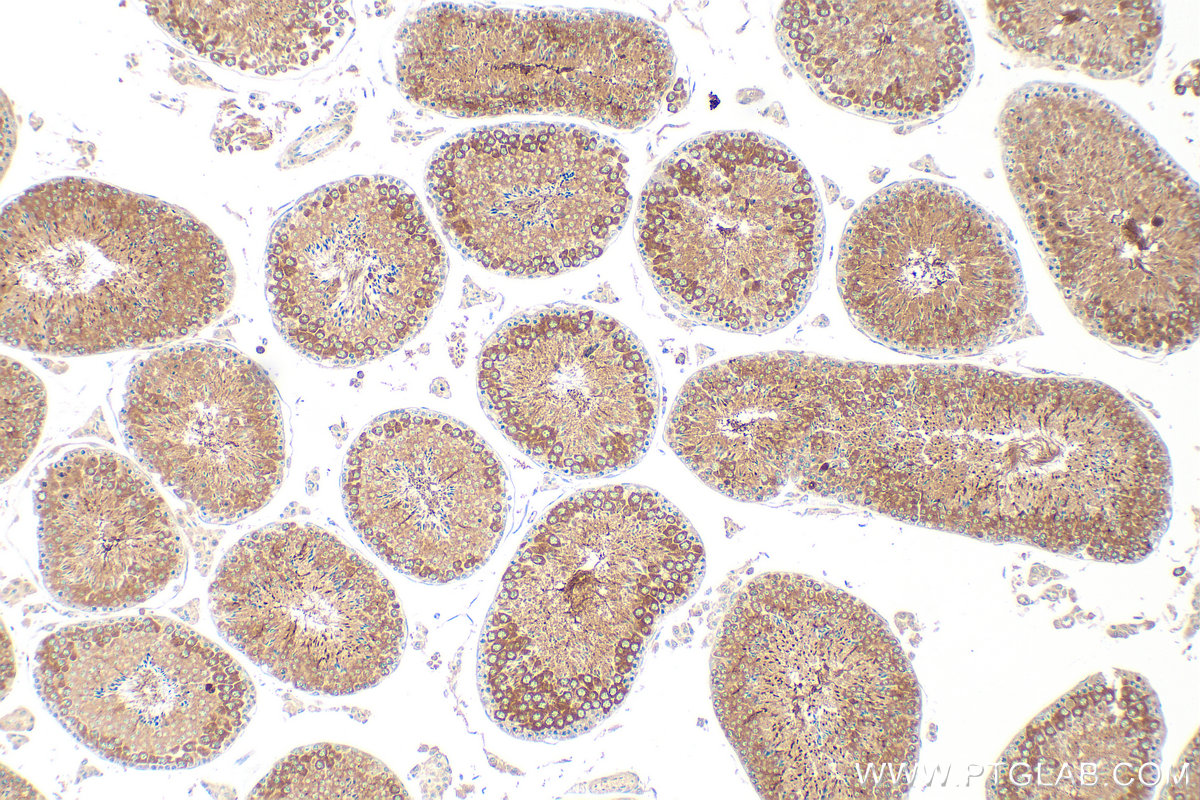Immunohistochemistry (IHC) staining of mouse testis tissue using IFT81 Polyclonal antibody (11744-1-AP)