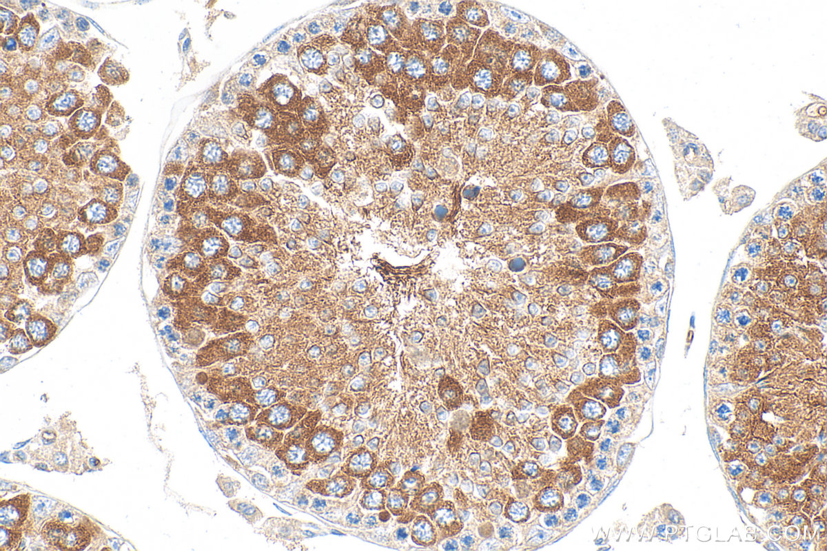 Immunohistochemistry (IHC) staining of mouse testis tissue using IFT81 Polyclonal antibody (11744-1-AP)