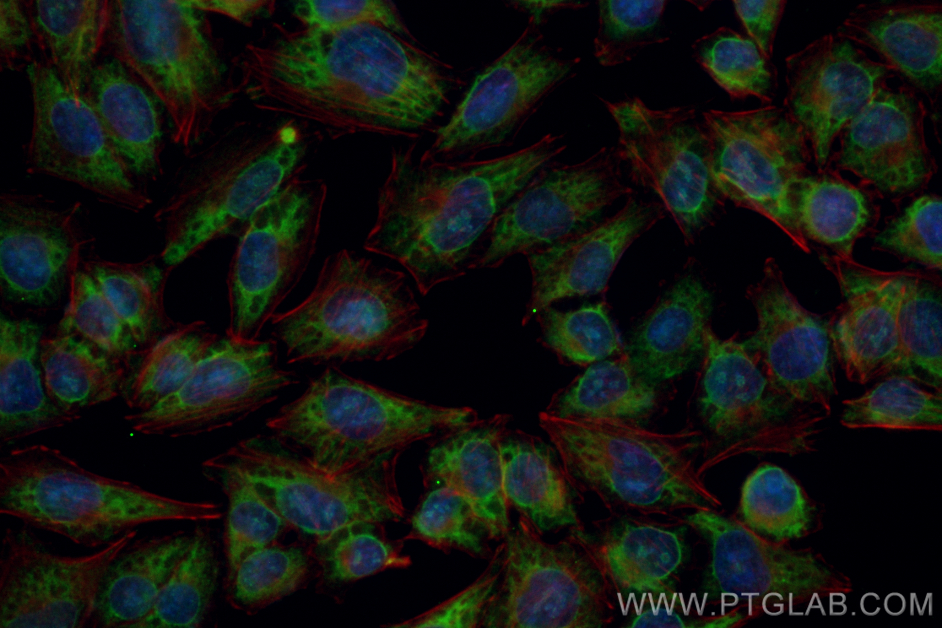 Immunofluorescence (IF) / fluorescent staining of A375 cells using CoraLite® Plus 488-conjugated IGF2BP1 Polyclonal a (CL488-22803)