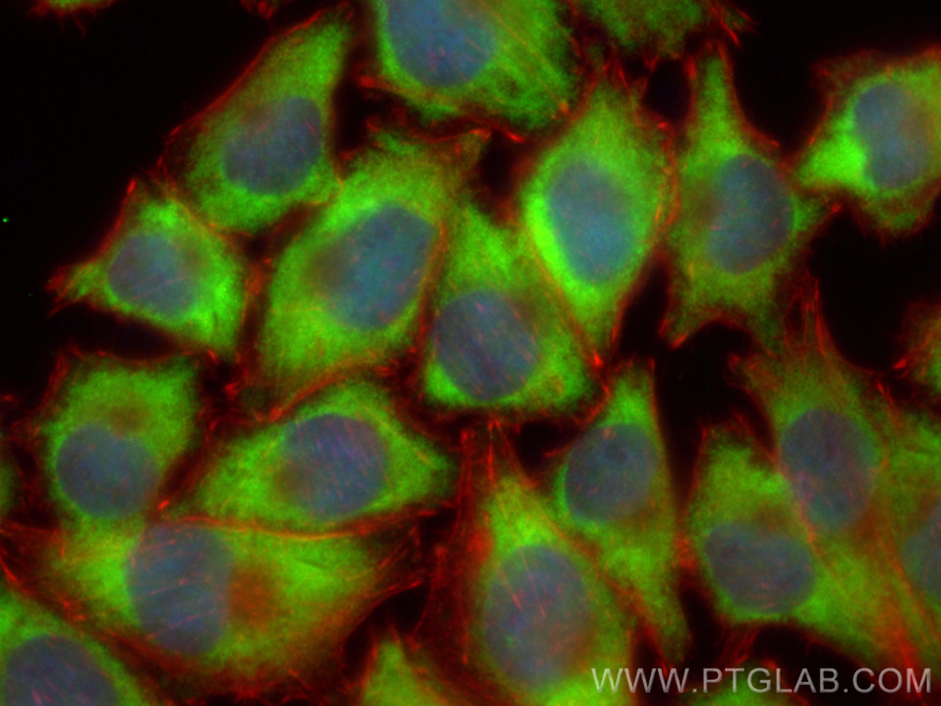 Immunofluorescence (IF) / fluorescent staining of A375 cells using CoraLite® Plus 488-conjugated IGF2BP1 Polyclonal a (CL488-22803)