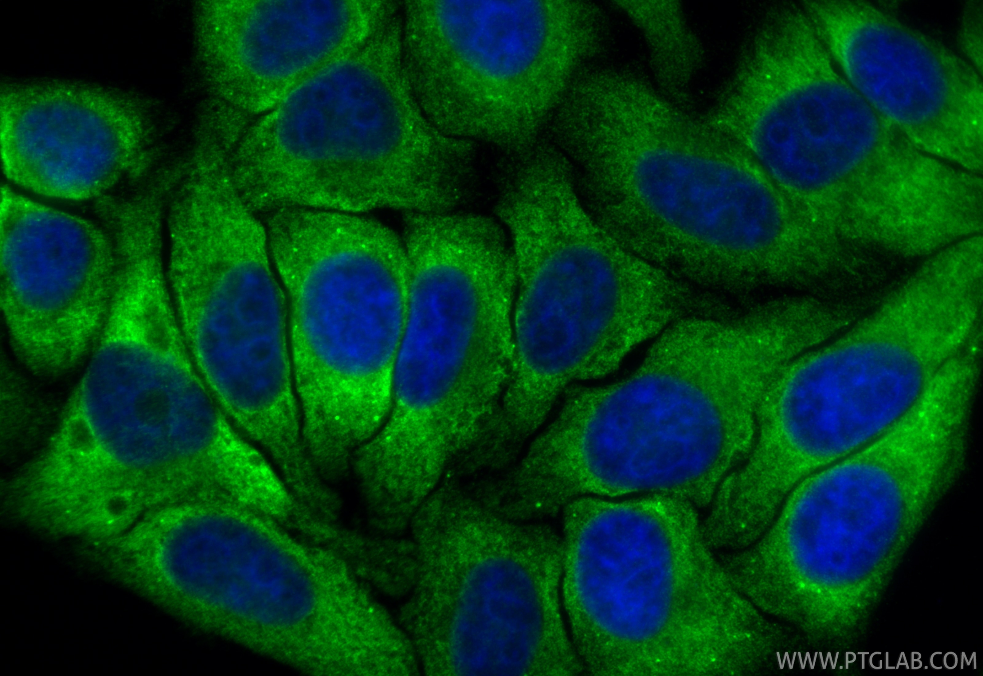 Immunofluorescence (IF) / fluorescent staining of HepG2 cells using IGF2BP2 Polyclonal antibody (11601-1-AP)