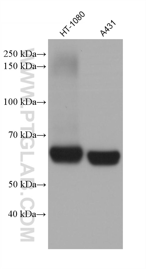 Western Blot (WB) analysis of various lysates using IGF2BP2 Monoclonal antibody (60647-1-Ig)