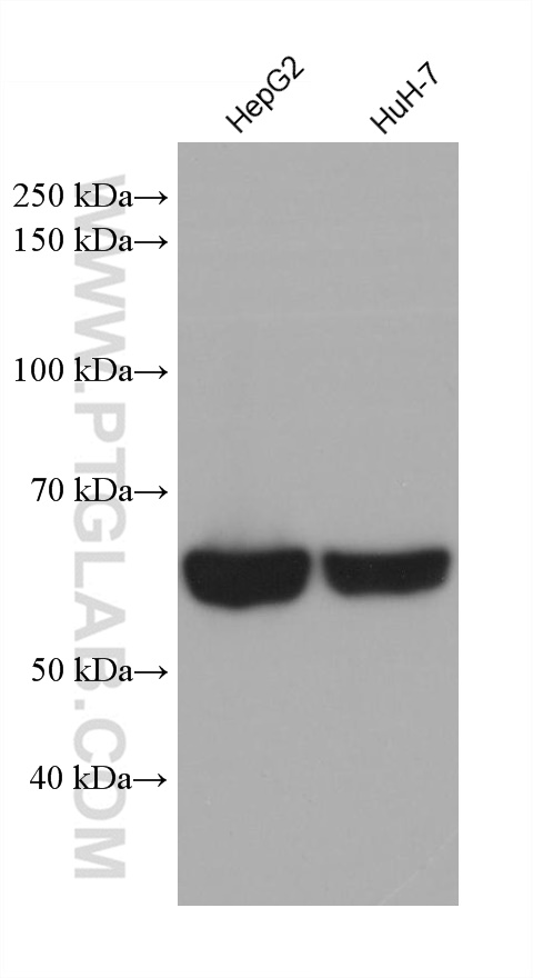 Western Blot (WB) analysis of various lysates using IGF2BP2 Monoclonal antibody (60647-1-Ig)