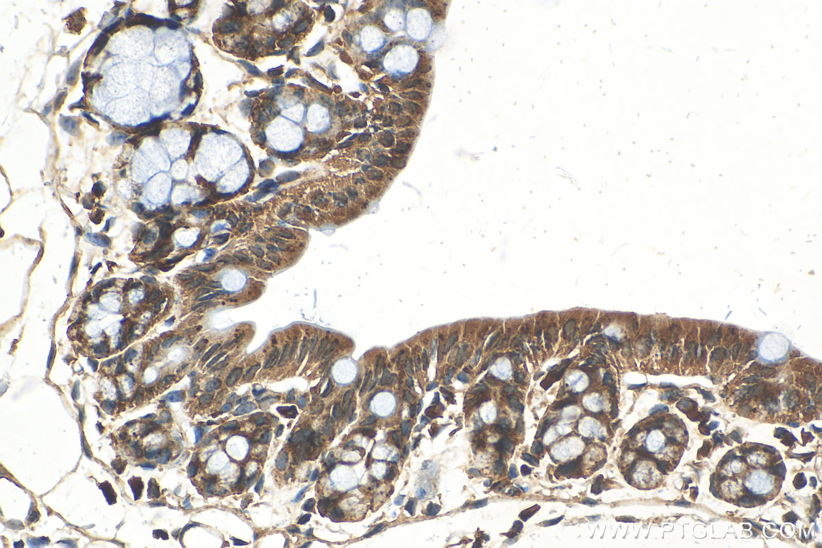 Immunohistochemistry (IHC) staining of mouse colon tissue using IGF2R-Specific Polyclonal antibody (20253-1-AP)
