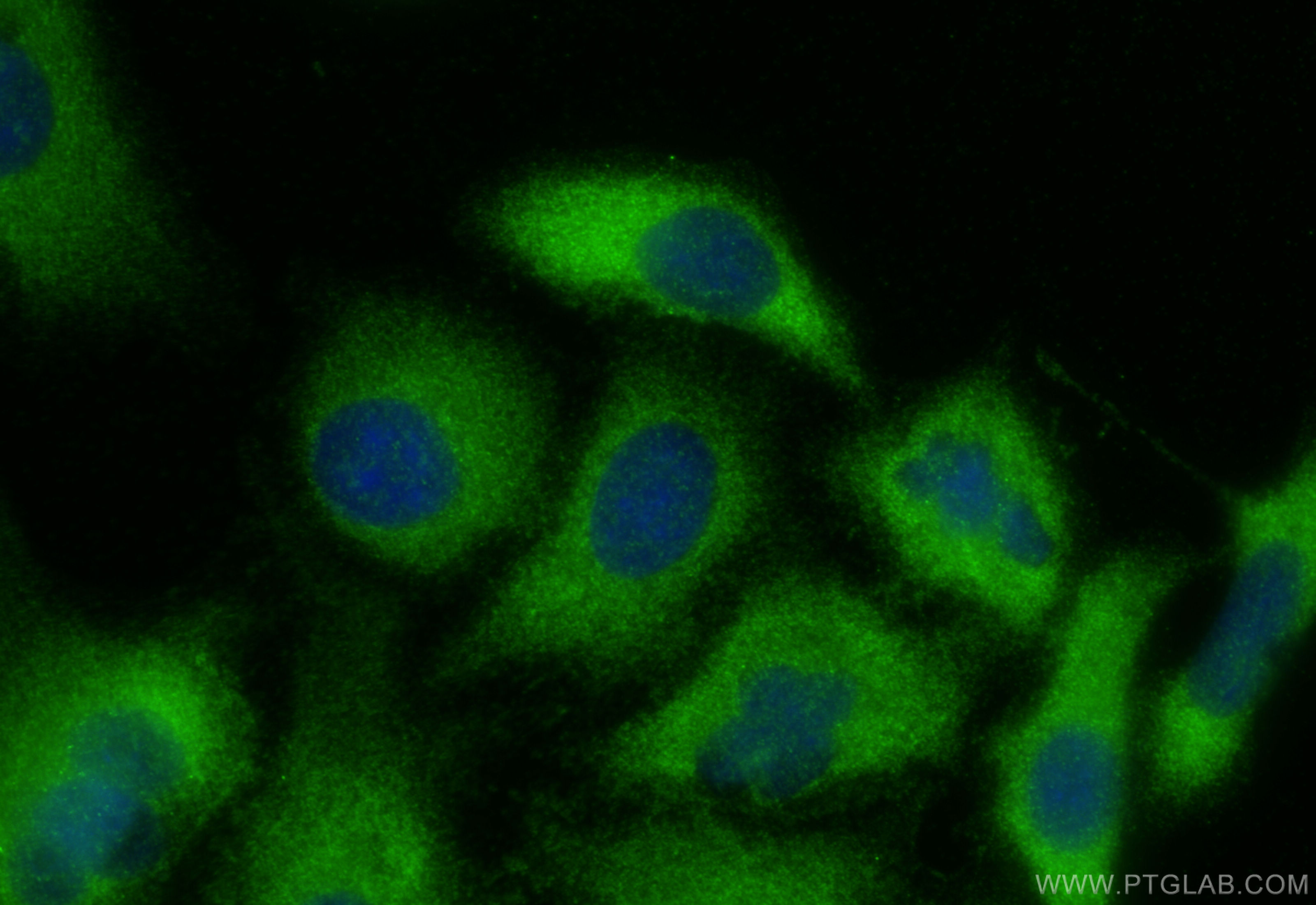 Immunofluorescence (IF) / fluorescent staining of A549 cells using IGFBP2 Polyclonal antibody (15699-1-AP)