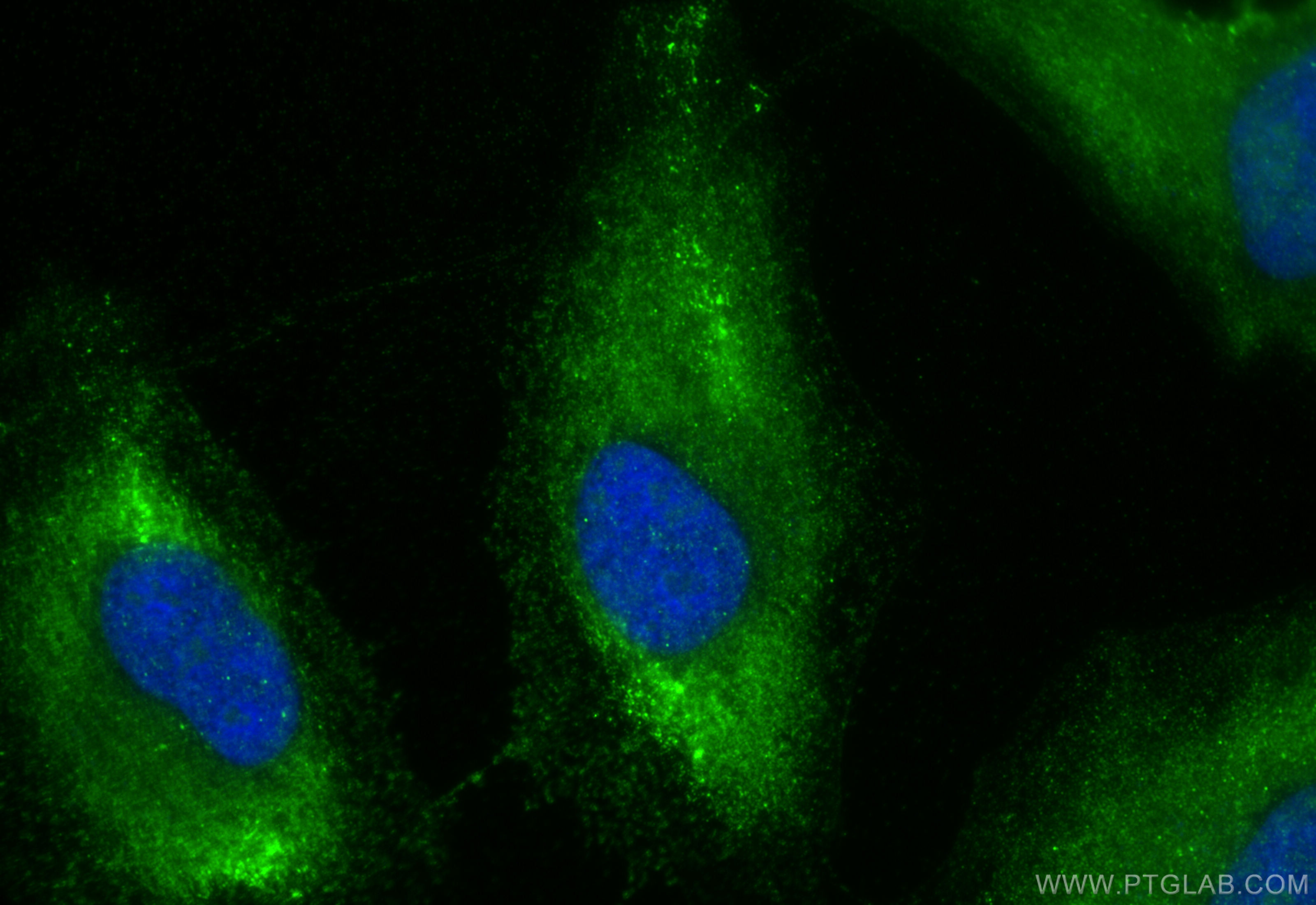 Immunofluorescence (IF) / fluorescent staining of HeLa cells using IGFBP2 Polyclonal antibody (15699-1-AP)