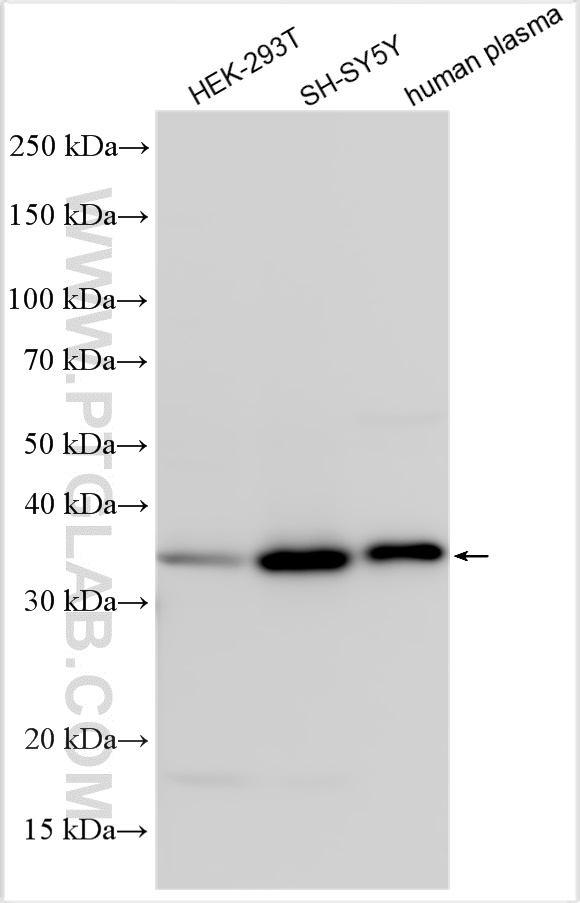 Western Blot (WB) analysis of various lysates using IGFBP2 Polyclonal antibody (31248-1-AP)