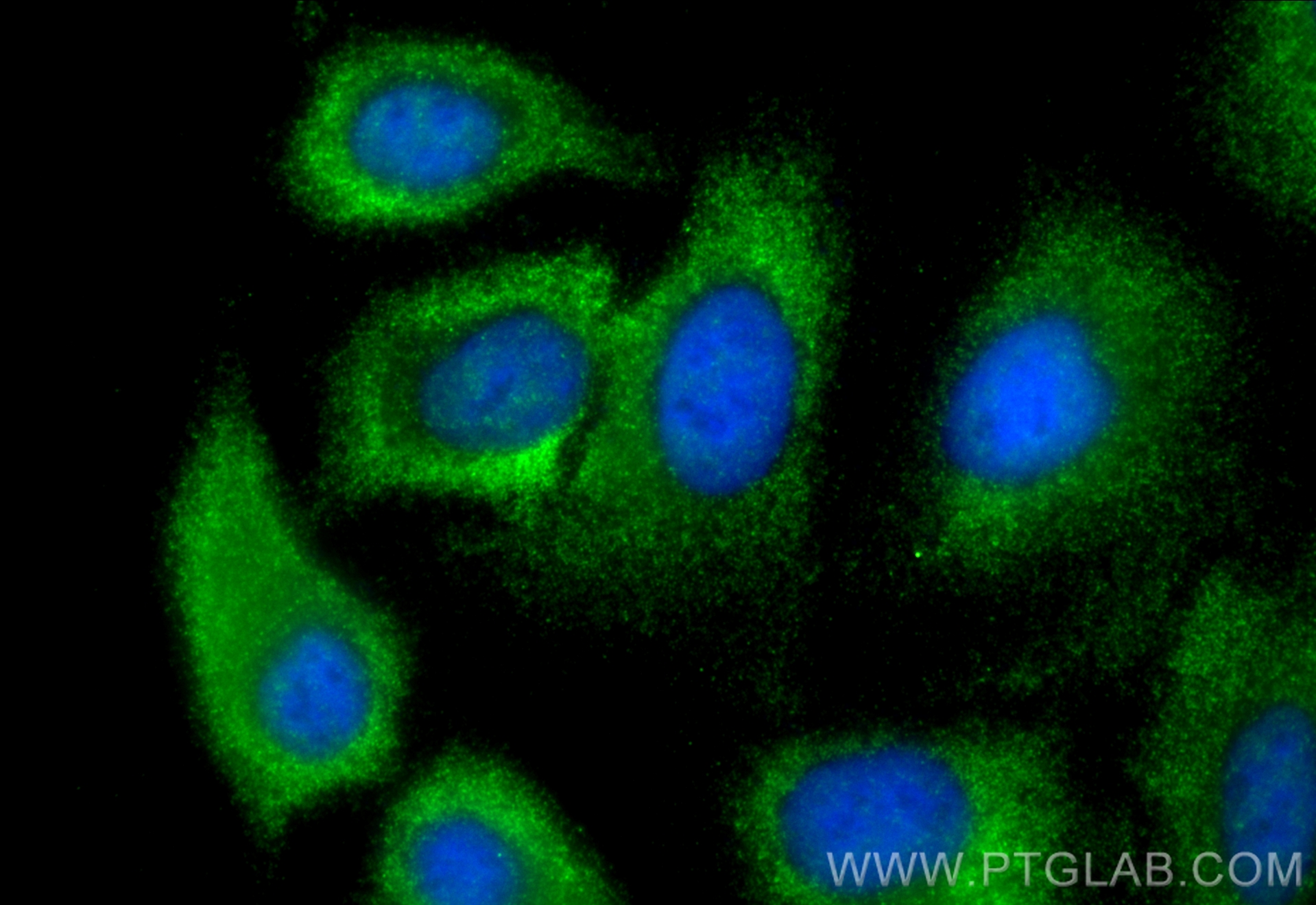 Immunofluorescence (IF) / fluorescent staining of A549 cells using IGFBP2 Monoclonal antibody (66644-1-Ig)