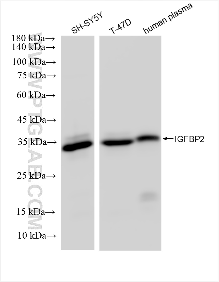 Western Blot (WB) analysis of various lysates using IGFBP2 Recombinant antibody (83283-3-RR)
