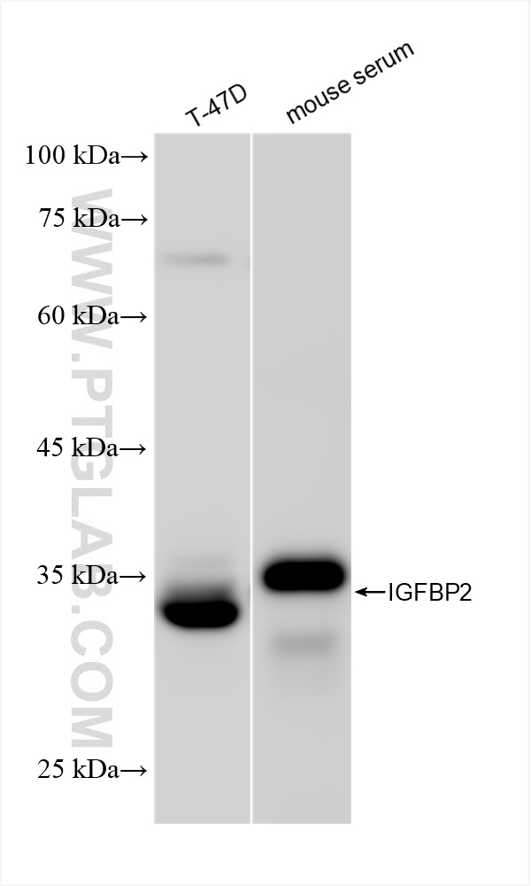 Western Blot (WB) analysis of various lysates using IGFBP2 Recombinant antibody (84092-1-RR)