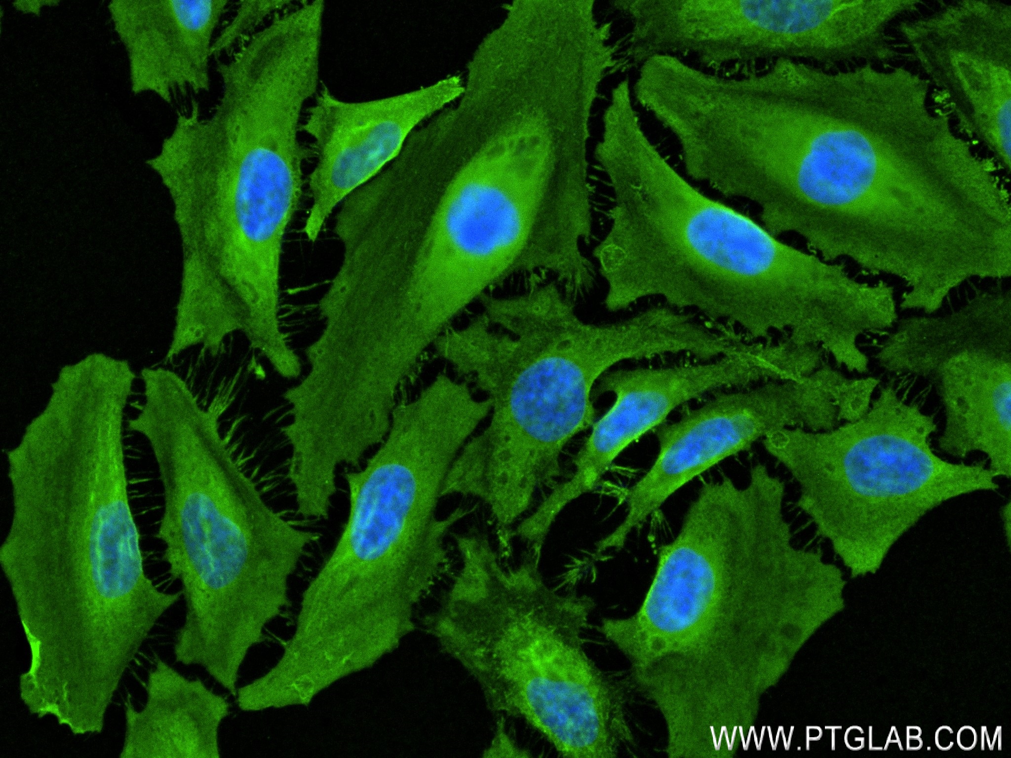 Immunofluorescence (IF) / fluorescent staining of HeLa cells using IGFBP2 Recombinant antibody (84092-3-RR)