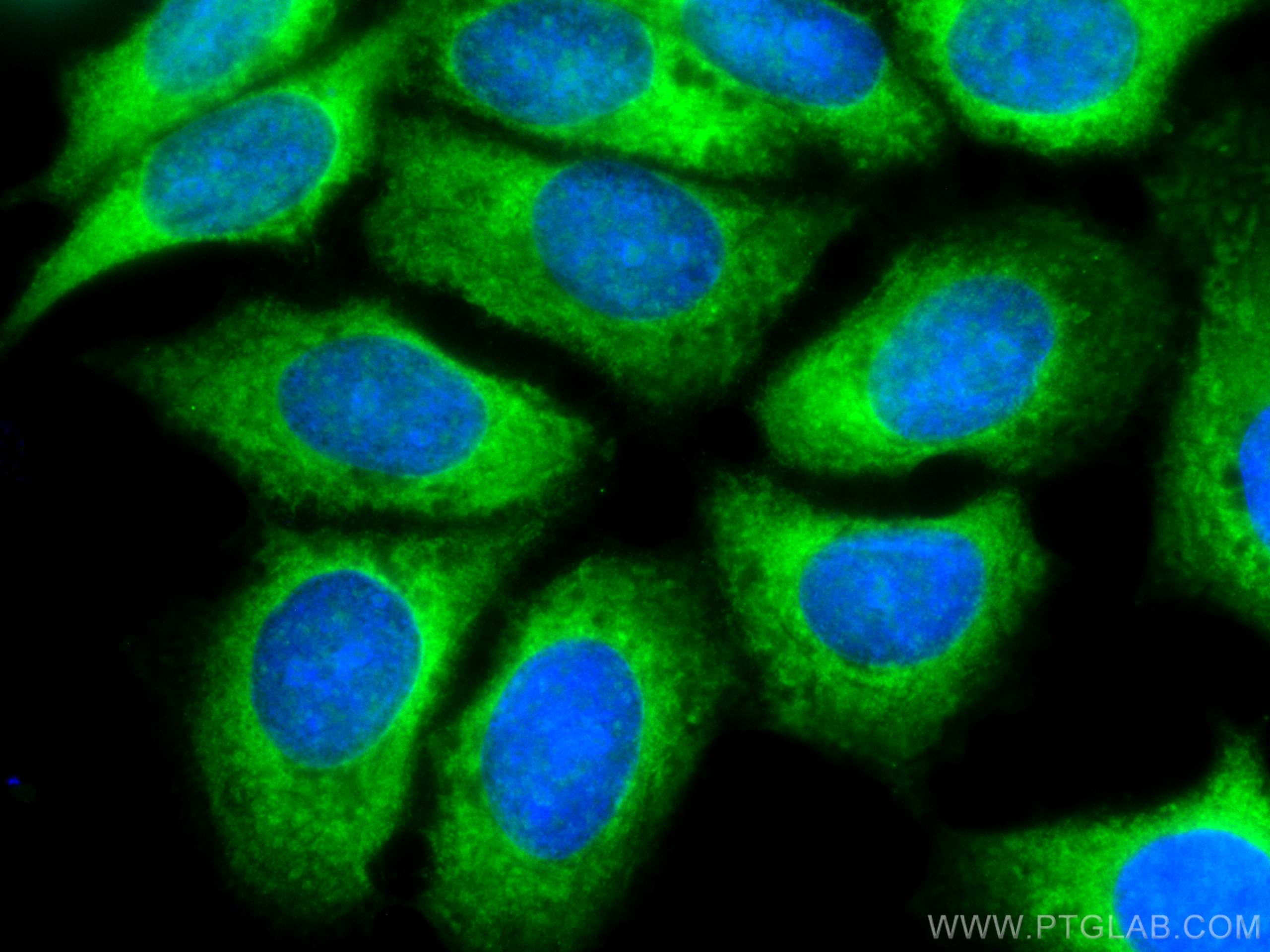 Immunofluorescence (IF) / fluorescent staining of MCF-7 cells using CoraLite® Plus 488-conjugated IGFBP2 Monoclonal an (CL488-66644)