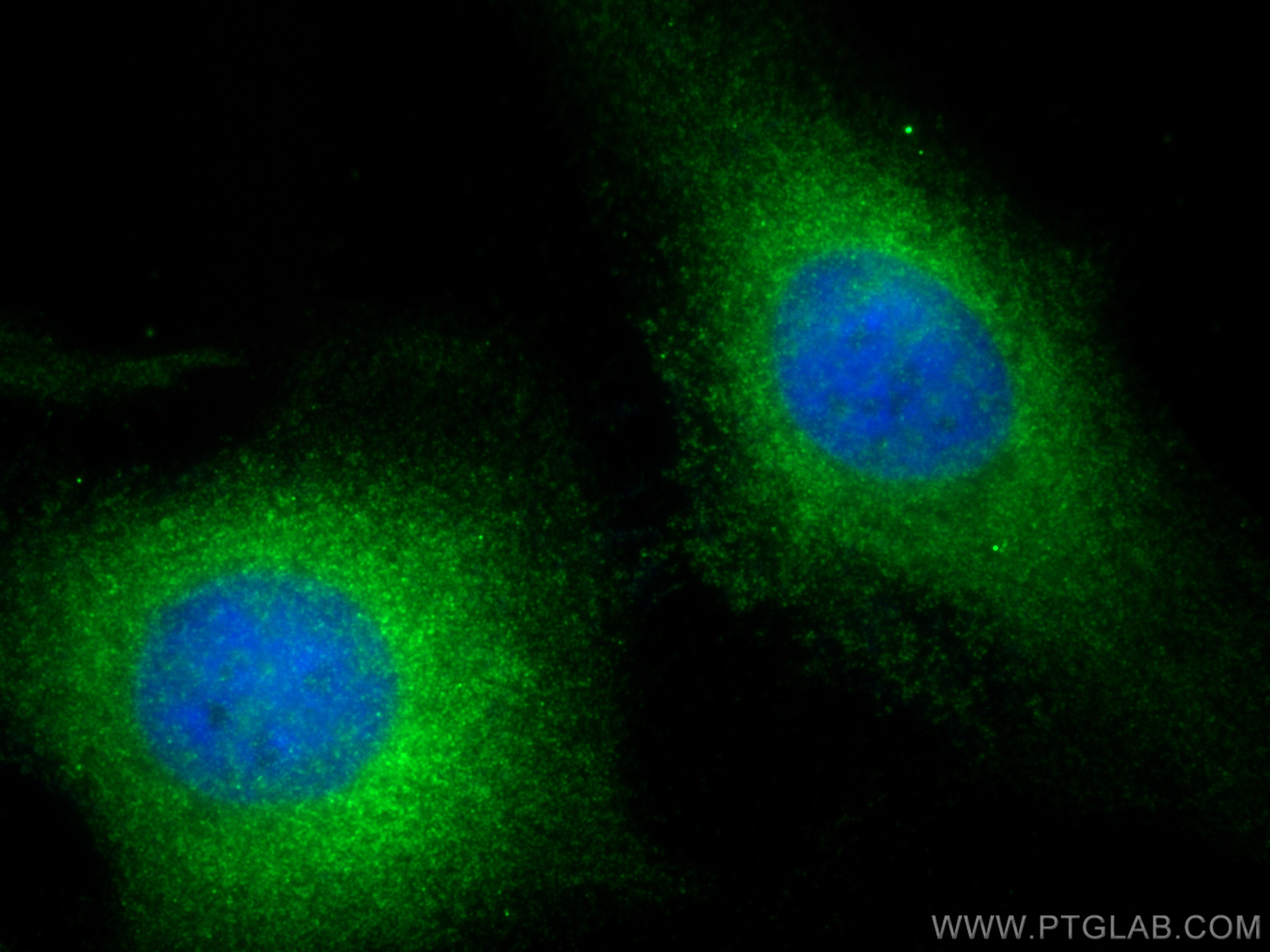 Immunofluorescence (IF) / fluorescent staining of HeLa cells using IGFBP3 Polyclonal antibody (10189-2-AP)