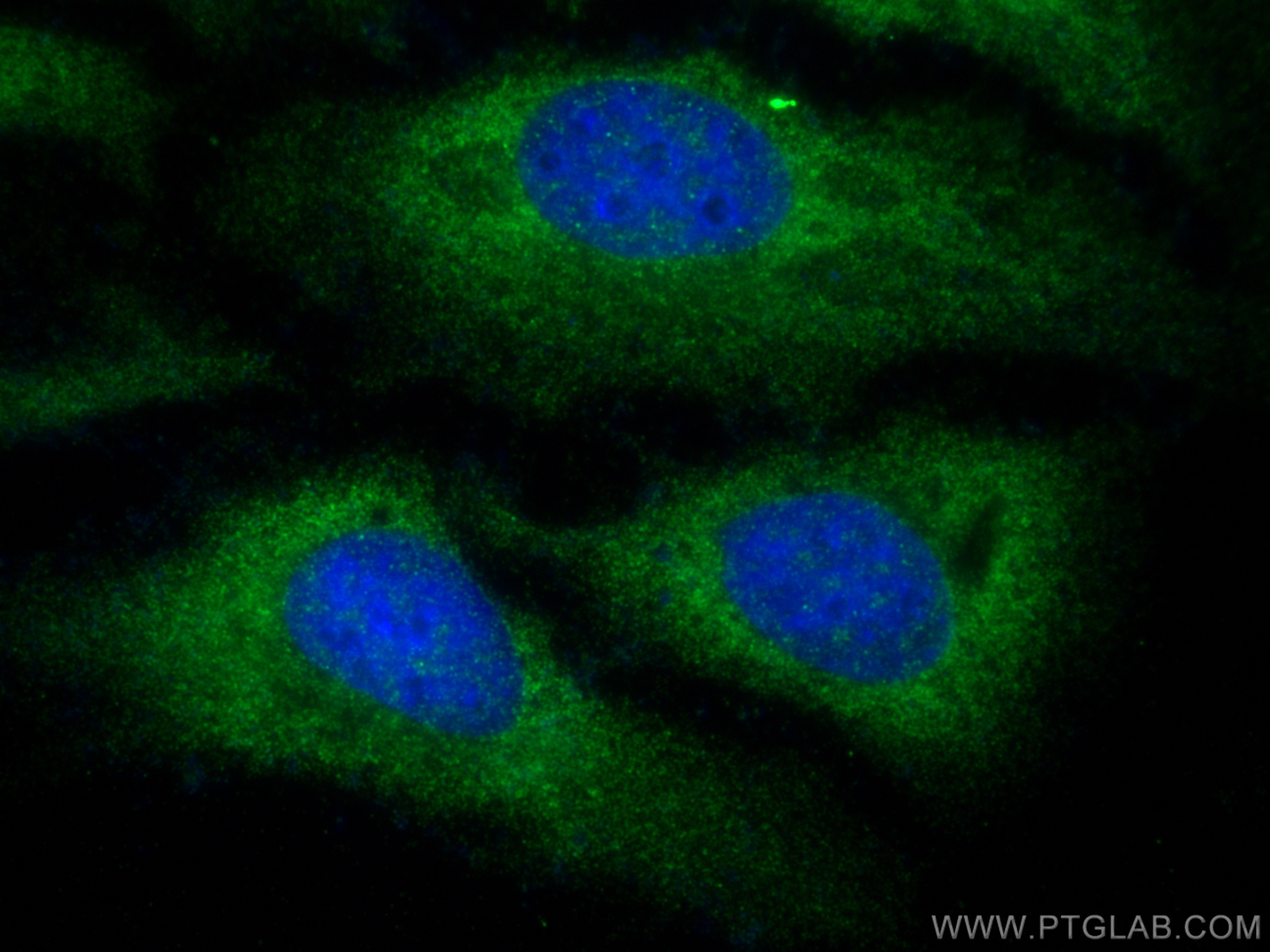 Immunofluorescence (IF) / fluorescent staining of HeLa cells using IGFBP3 Polyclonal antibody (10189-2-AP)