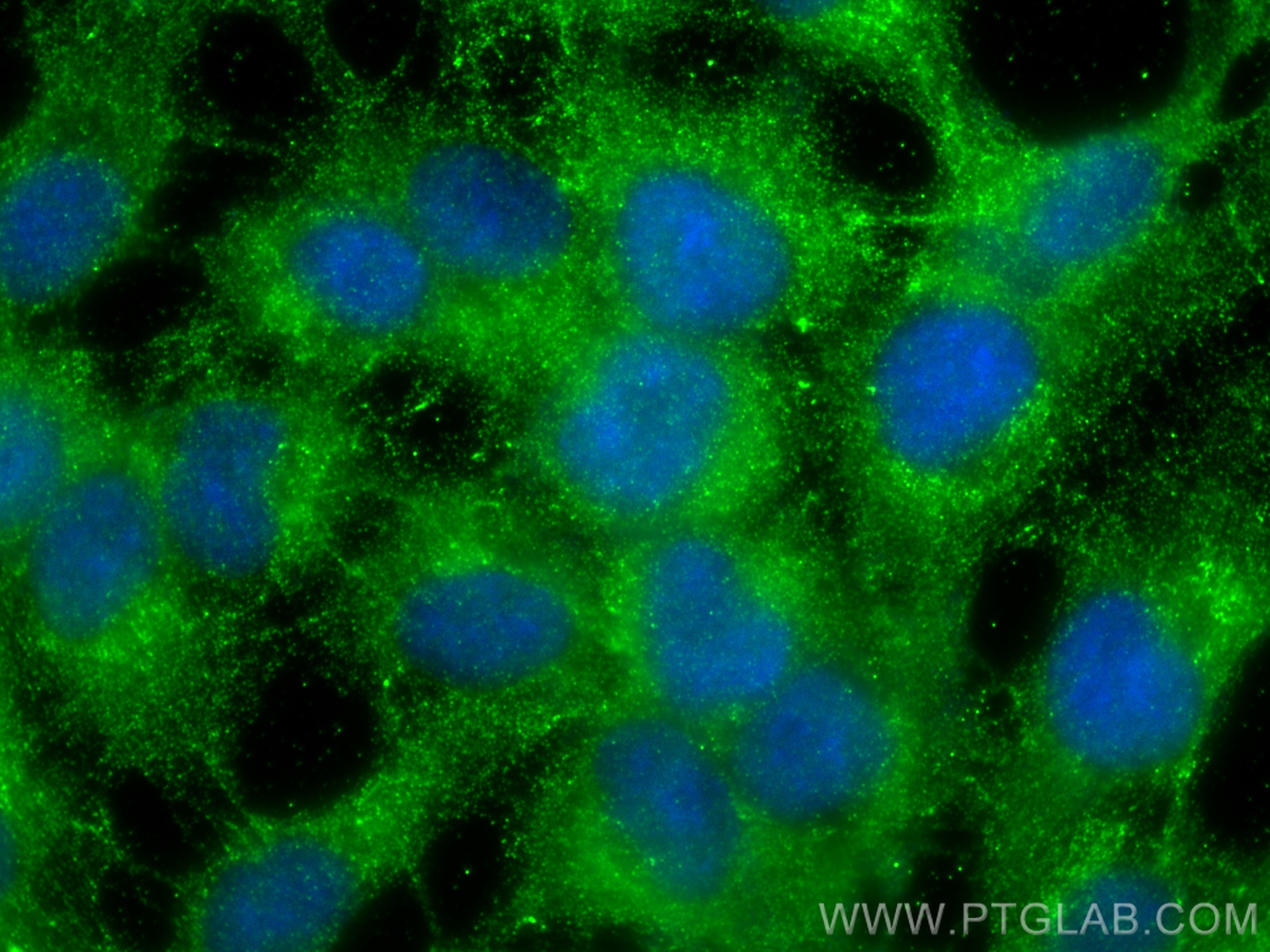 Immunofluorescence (IF) / fluorescent staining of HaCaT cells using IGFBP6 Monoclonal antibody (67567-1-Ig)