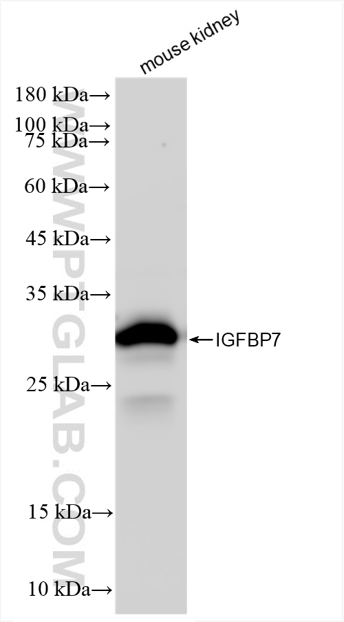 Western Blot (WB) analysis of mouse kidney tissue using IGFBP7 Recombinant antibody (83292-5-RR)