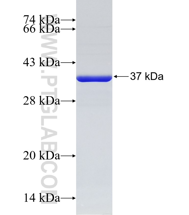 IGFBP7 fusion protein Ag33040 SDS-PAGE