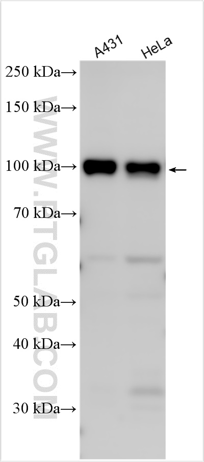 Western Blot (WB) analysis of various lysates using IGFN1 Polyclonal antibody (25095-1-AP)