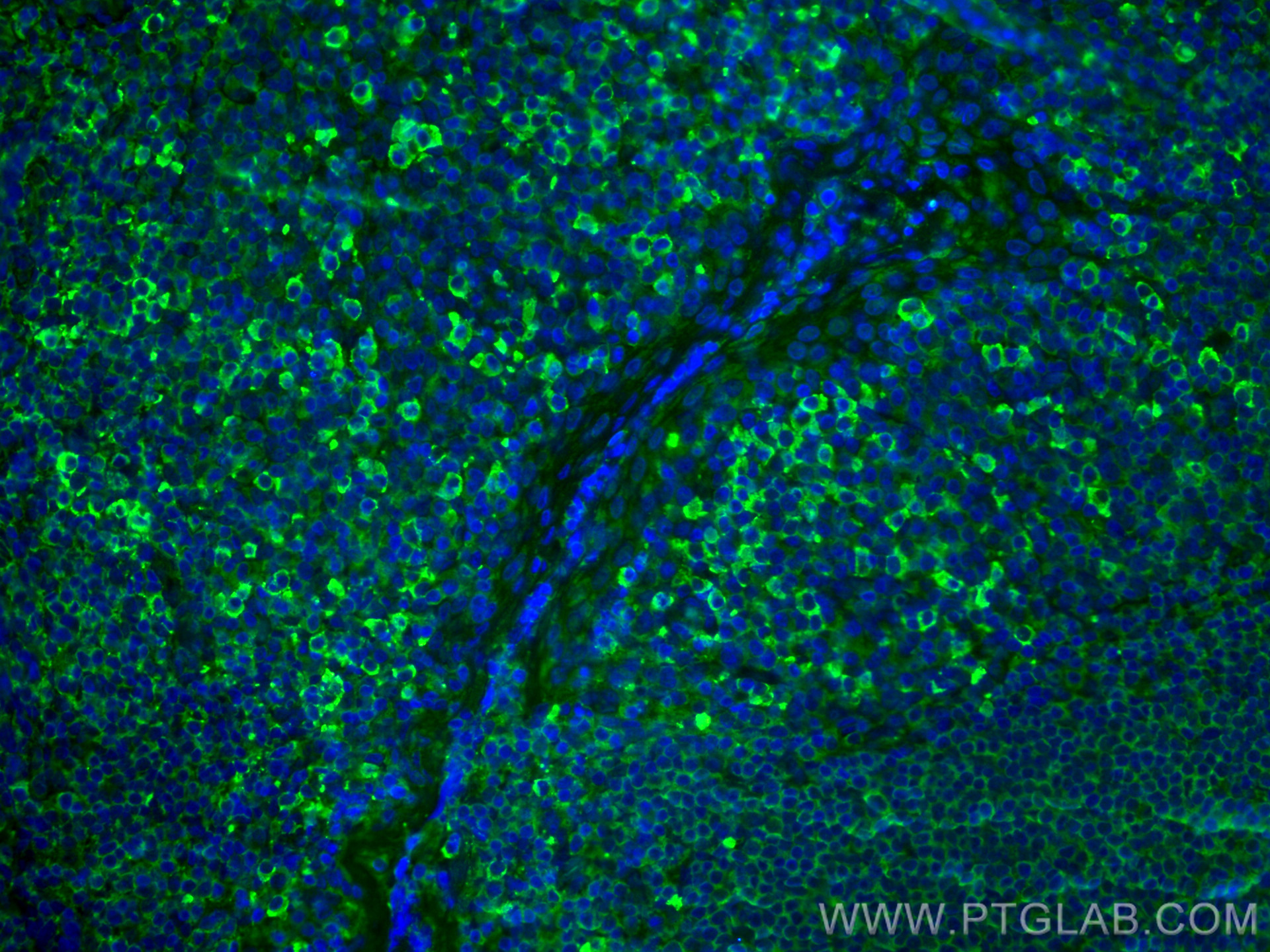 Immunofluorescence (IF) / fluorescent staining of human tonsillitis tissue using Human IgA Monoclonal antibody (60099-1-Ig)