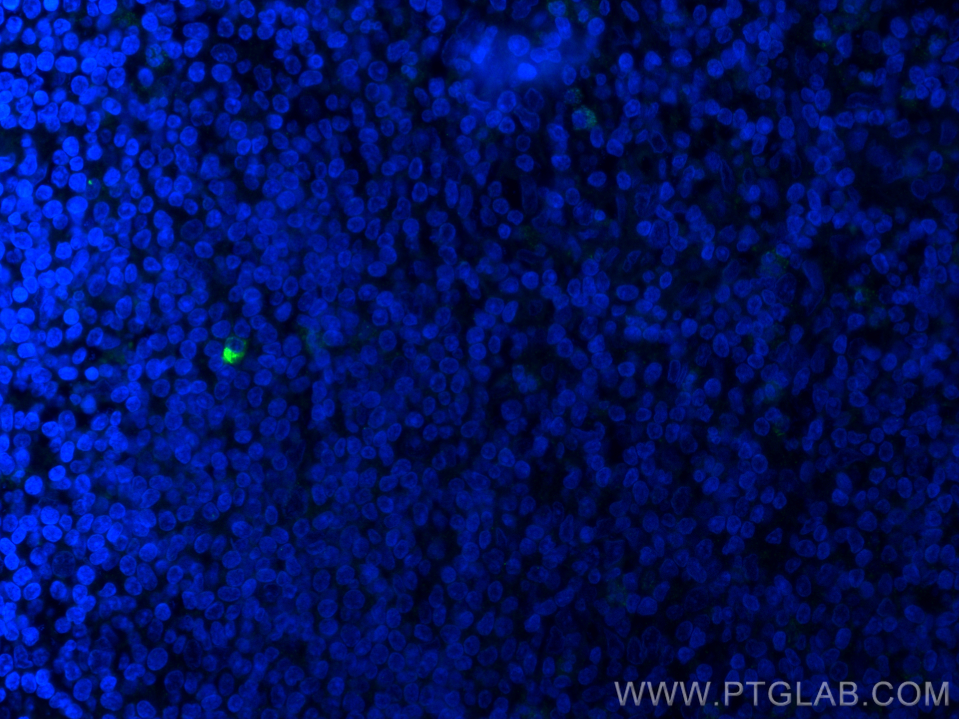 Immunofluorescence (IF) / fluorescent staining of human appendicitis tissue using human IgM Monoclonal antibody (66484-1-Ig)