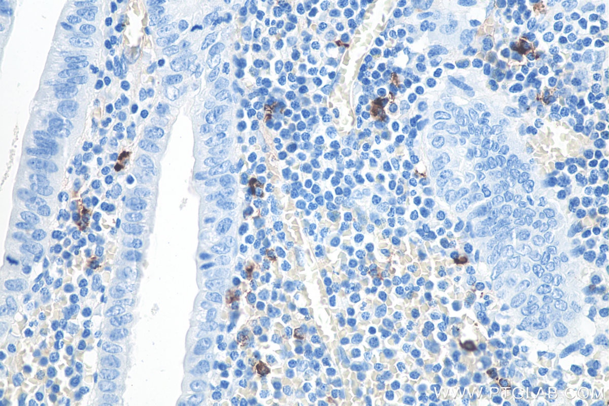 Immunohistochemistry (IHC) staining of human appendicitis tissue using human IgM Monoclonal antibody (66484-1-Ig)